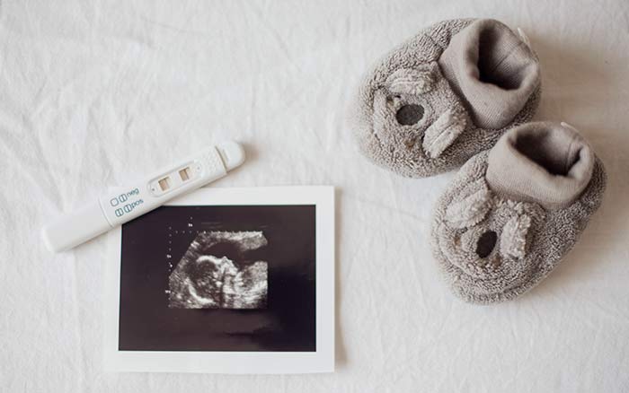 Proses Reproduksi pada Wanita