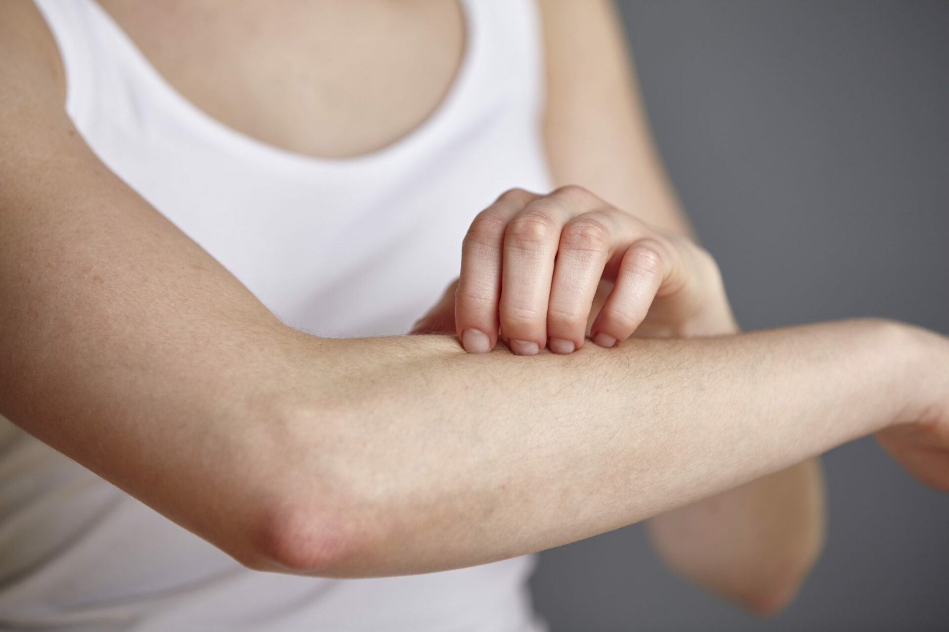 Impetigo: Penyebab, Gejala, dan Cara Mengobati Infeksi Kulit Menular Ini