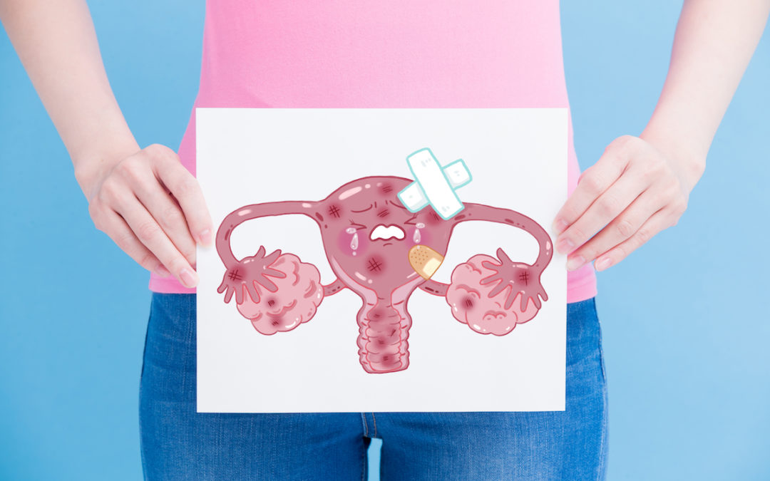 Ca Endometrium Adalah, Kenali Lebih Lanjut di Sini