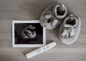Mengenal Pengapuran Plasenta, Ketahui Gejala dan Cara Pencegahannya