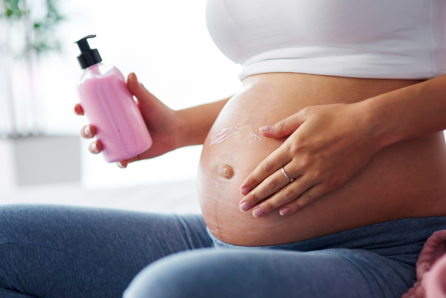 Inilah Cara Menghilangkan Stretch Mark Setelah Melahirkan Caesar
