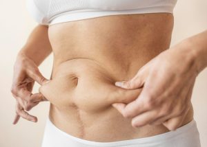 6 Cara Mudah Langsing Setelah Melahirkan