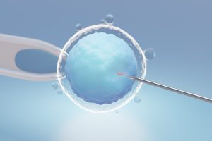 Apa Itu ICSI Dan Bagaimana Prosedur Ini Dilakukan?