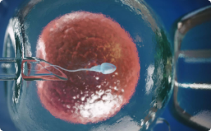 In Vitro Fertilization (IVF): Definition, Procedure, Preparation, Advantages, and Cost