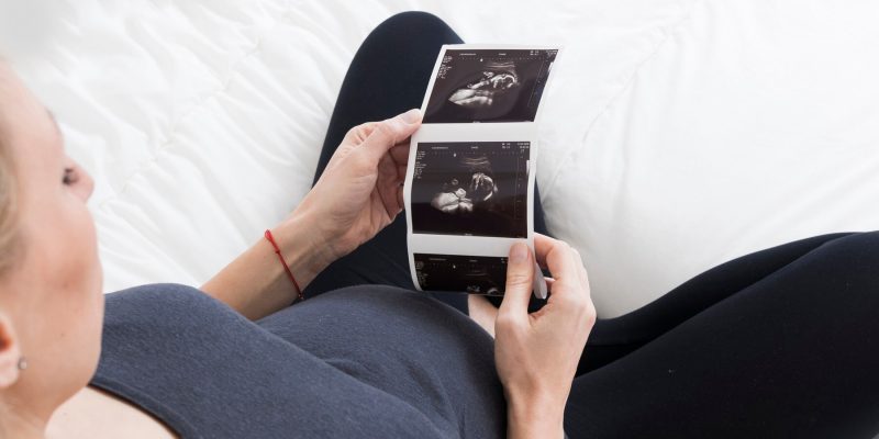 Velamentous Cord Insertion: Penyebab, Gejala dan Cara Pencegahannya