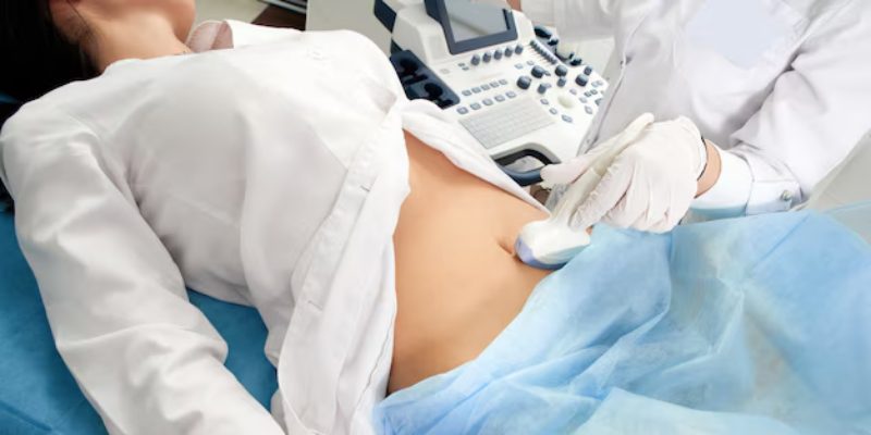 Memahami USG Transabdominal: Panduan Lengkap untuk Ibu Hamil