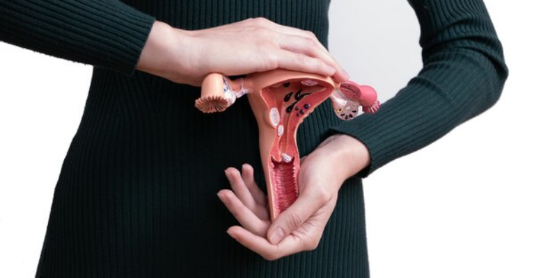 Prolaps Uteri: Gejala, Penyebab, dan Pengobatan