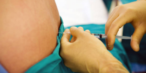Bius Epidural Saat Persalinan, Adakah Efek Sampingnya?