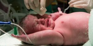 Mengenal Apa Itu Vernix Caseosa: Pelindung Ajaib Kulit Bayi dari Dalam Kandungan