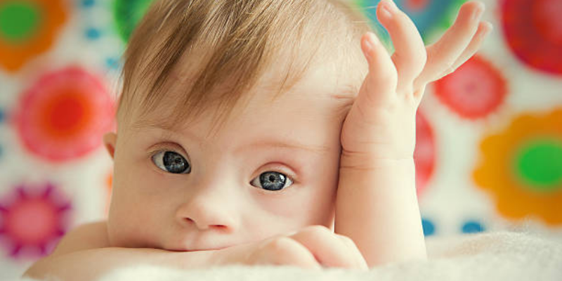 Memahami Penyebab Bayi Down Syndrome