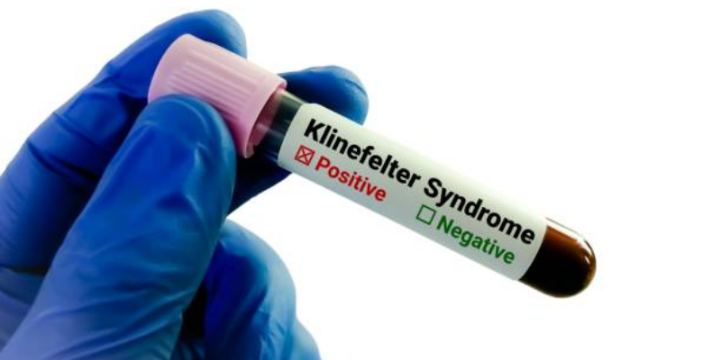 Memahami Sindrom Klinefelter dan Dampaknya